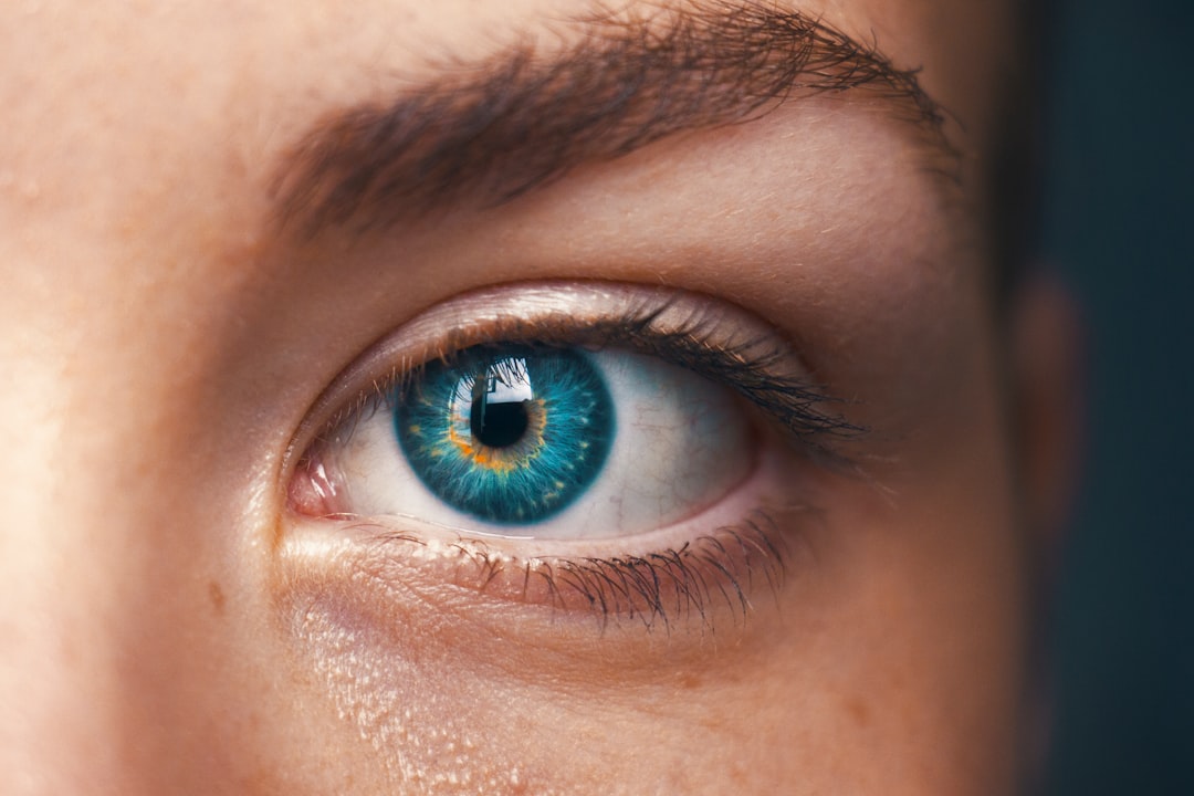 5 Reasons to Choose Blue Fin Vision® for Eye Freckle Removal