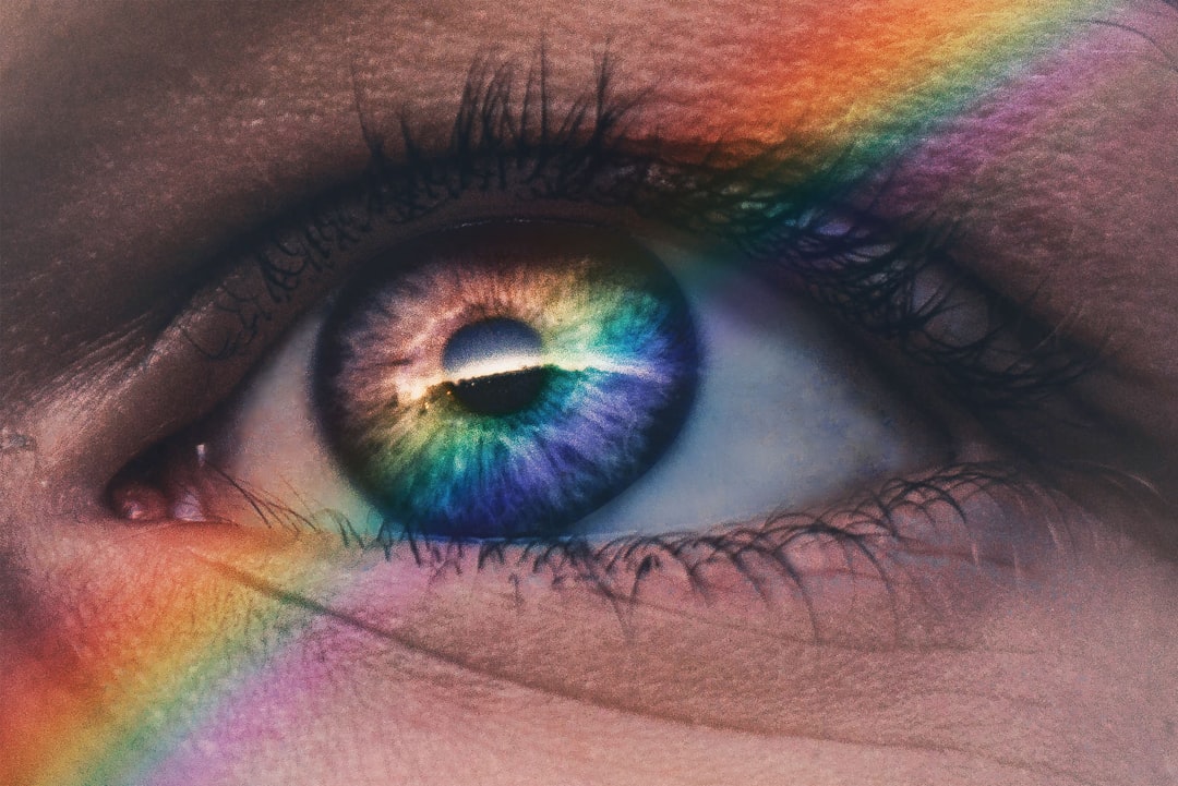 Looking for the Best Place to Get Conjunctival Naevus Removal in London?