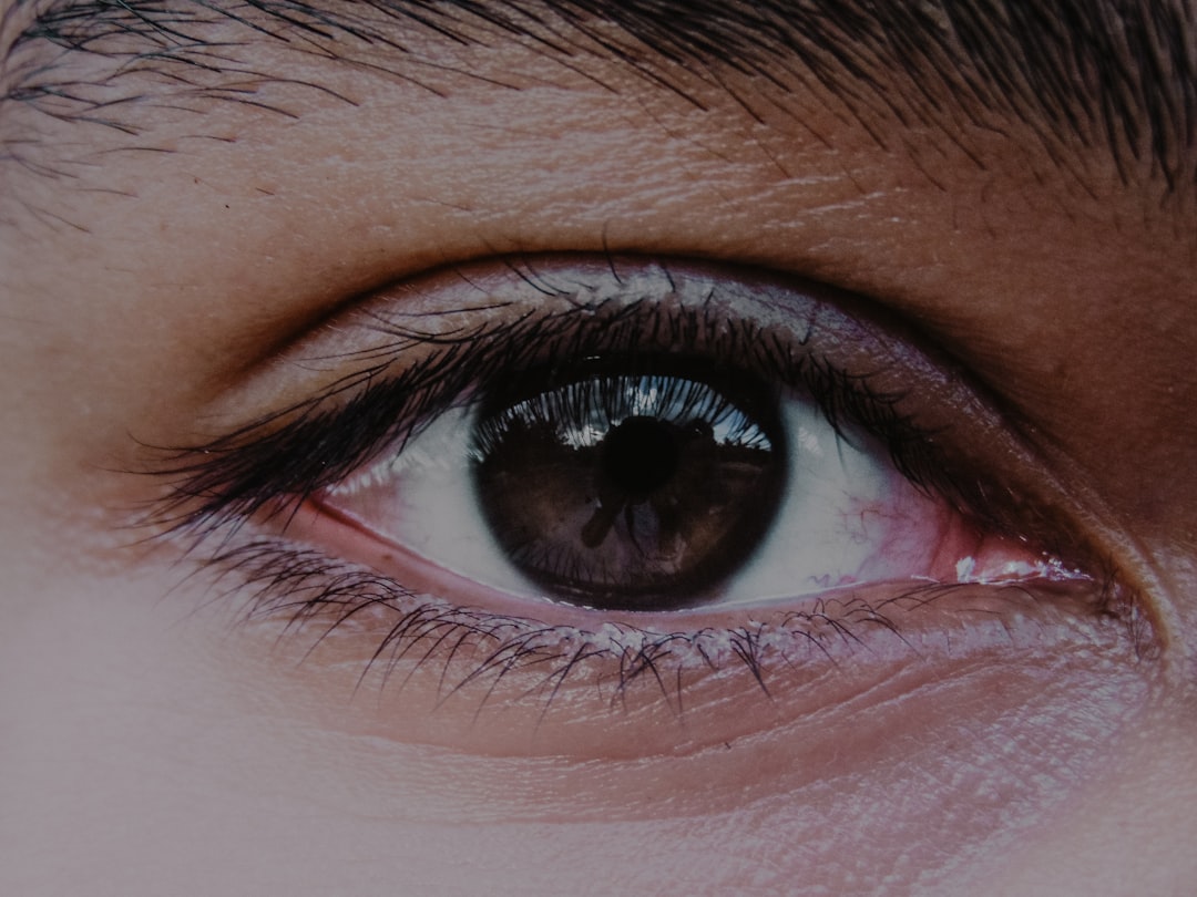 How Much Does Private Conjunctival Naevus Removal Cost on Harley Street?