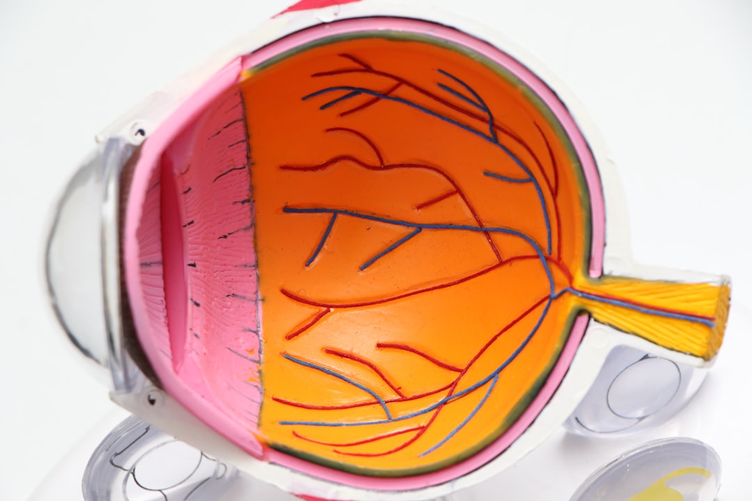 Implantable Collamer Lens Surgery