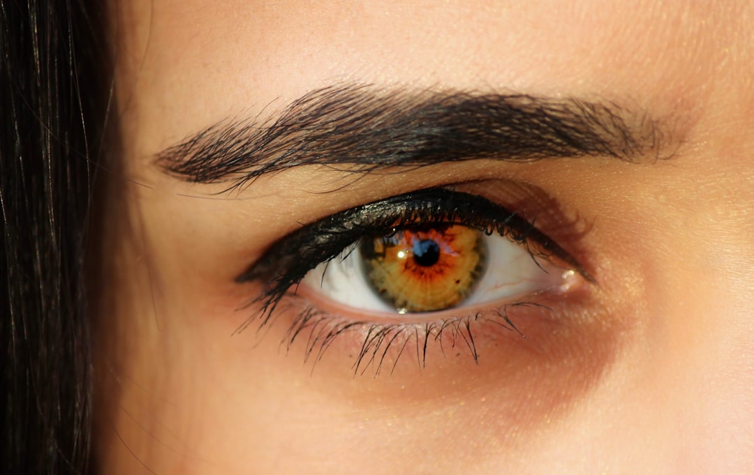 IOL Lens Positions: In‑the‑Bag, Sulcus and Anterior Chamber Explained